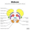 Brainstem cross-sectional anatomy (diagrams) (Radiopaedia 81958-95923 Entire brainstem 1).jpeg