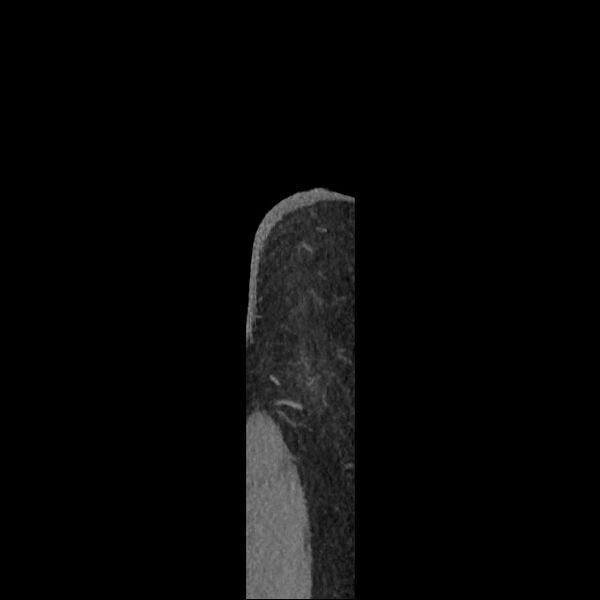 File:Normal CT angiogram of pelvis (Radiopaedia 45390-49430 C 1).jpg