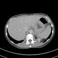 Normal multiphase CT liver (Radiopaedia 38026-39996 Axial C+ delayed 16).jpg