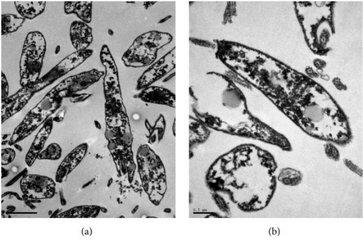 a,b)Ultrastructure of Leishmania infantum promastigotes incubated for 24 hours