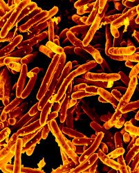 Scanning electron micrograph of Mycobacterium tuberculosis bacteria, which cause TB