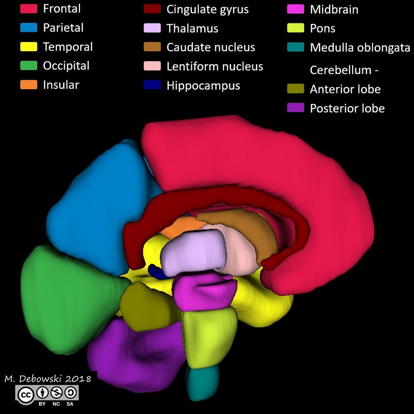 Brain lobes - annotated MRI (Radiopaedia 61691-69700 3D reconstruction 84).JPG