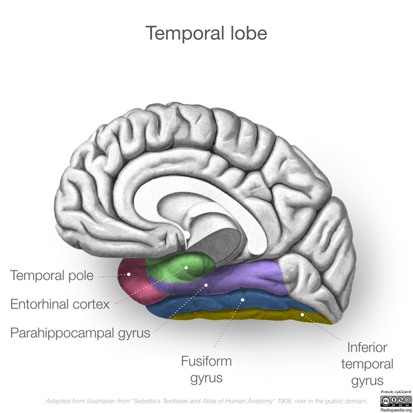 File:Neuroanatomy- medial cortex (diagrams) (Radiopaedia 47208-52697 Temporal lobe gyri 2).png