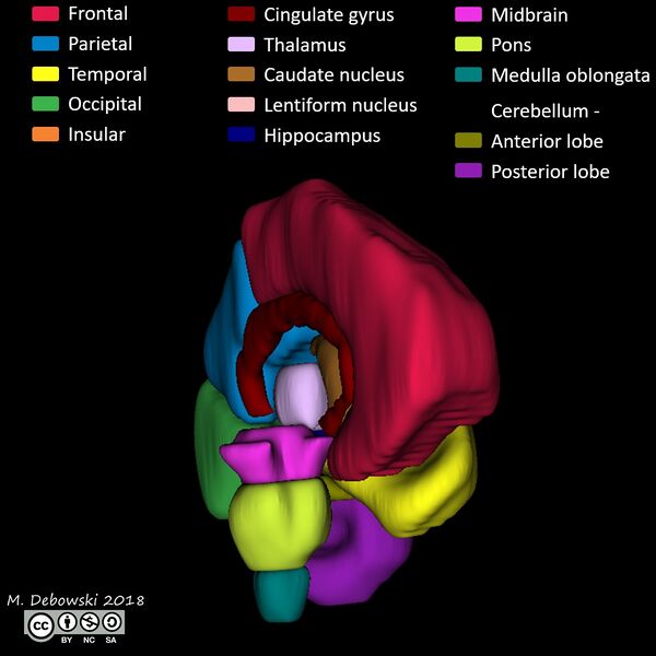 File:Brain lobes - annotated MRI (Radiopaedia 61691-69700 3D reconstruction 13).JPG