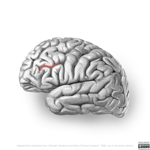 File:Neuroanatomy- lateral cortex (diagrams) (Radiopaedia 46670-51202 B 4).png