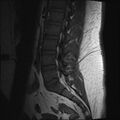 Normal lumbar spine MRI (Radiopaedia 47857-52609 Sagittal T1 8).jpg