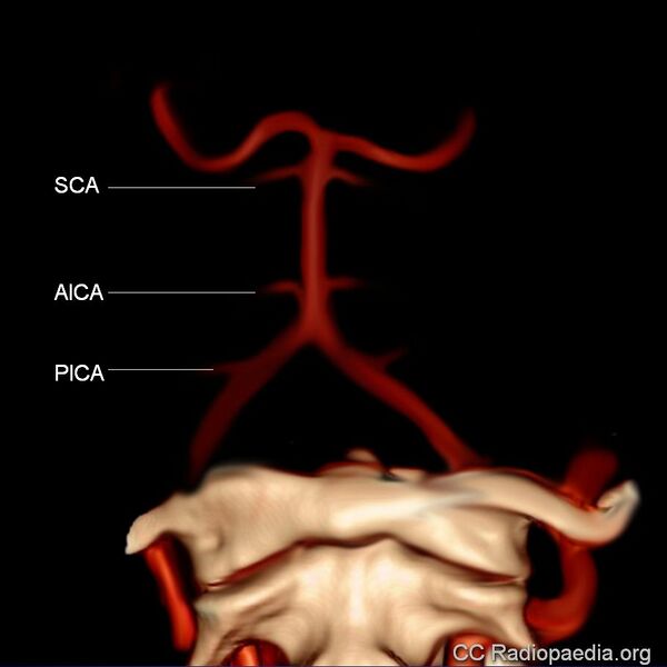 File:Basilar artery branches (illustration) (Radiopaedia 36153).jpg