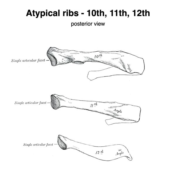 File:Atypical ribs - 10, 11, 12 (Gray's illustration) (Radiopaedia 83043).jpeg