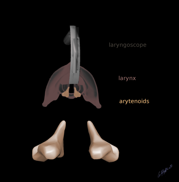 File:Arytenoid cartilages (illustration) (Radiopaedia 76316-87956 B 1).png