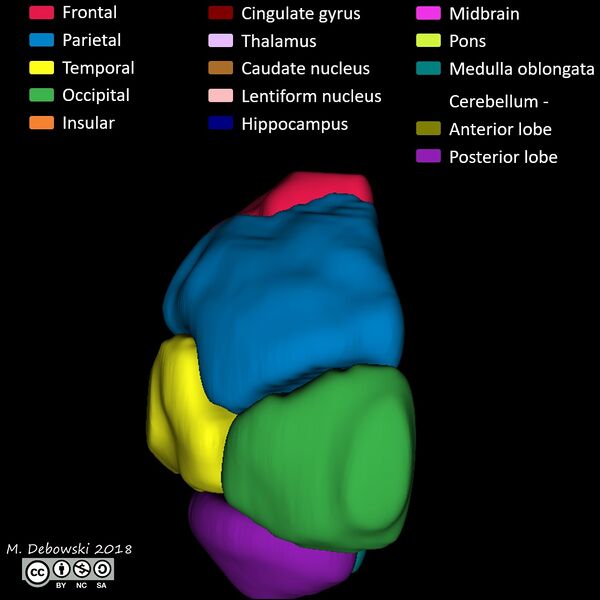File:Brain lobes - annotated MRI (Radiopaedia 61691-69700 3D reconstruction 61).JPG