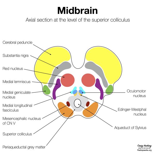 File:Brainstem cross-sectional anatomy (diagrams) (Radiopaedia 81958-95923 Upper midbrain 1).jpeg