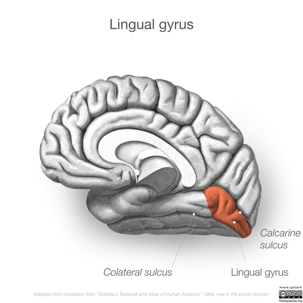 File:Neuroanatomy- medial cortex (diagrams) (Radiopaedia 47208-52697 Lingual gyrus 3).png