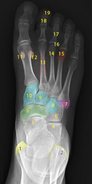File:Normal radiographic anatomy of the foot (Radiopaedia 49119).jpg