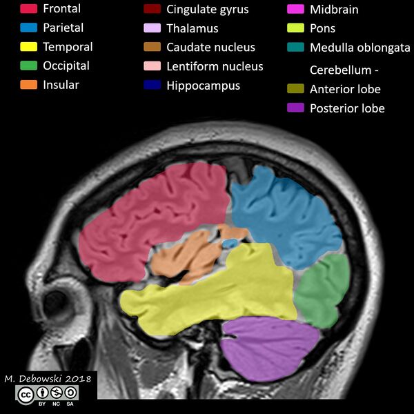 File:Brain lobes - annotated MRI (Radiopaedia 61691-69700 Sagittal 62).JPG