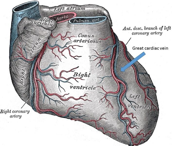 File:Cardiac vessels - Gray's anatomy illustrations (Radiopaedia 34282-35573 A 1).jpg