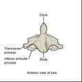 Bones and ligaments of the vertebral column (illustrations) (Radiopaedia 42770-45935 K 1).jpg