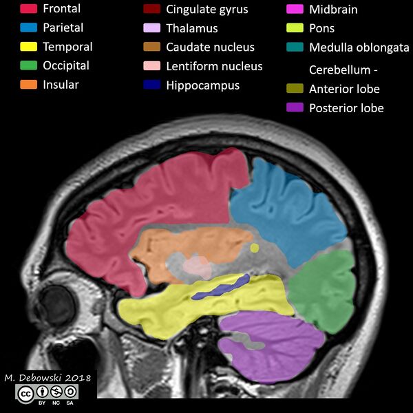 File:Brain lobes - annotated MRI (Radiopaedia 61691-69700 Sagittal 58).JPG