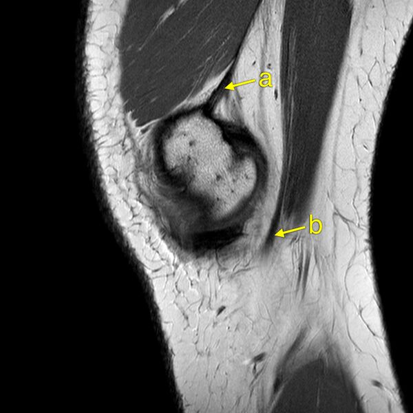 File:Anatomy Quiz (MRI knee) (Radiopaedia 43478-46865 A 2).jpeg