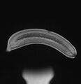 Banana (Radiopaedia 52587-58499 Sagittal PD 7).jpg