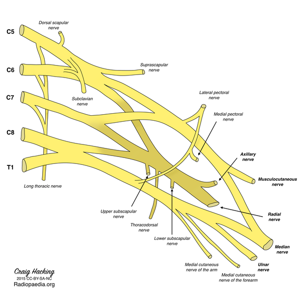 File:Brachial plexus (diagram) (Radiopaedia 37612-39492 Labelled nerves 1).png