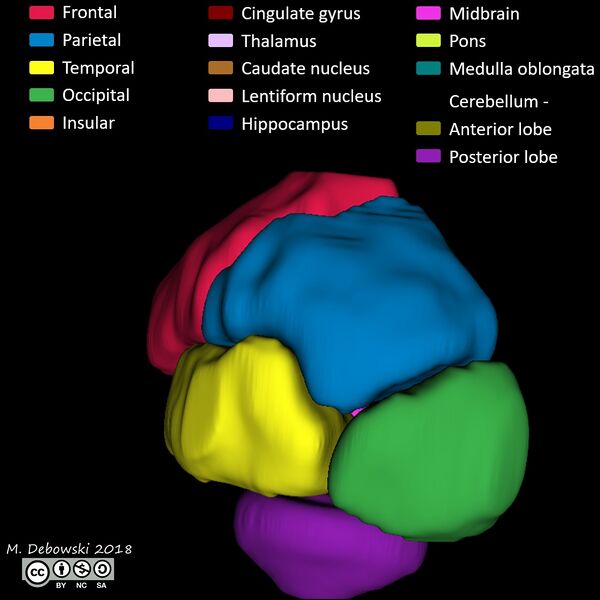 File:Brain lobes - annotated MRI (Radiopaedia 61691-69700 3D reconstruction 54).JPG
