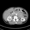 Normal multiphase CT liver (Radiopaedia 38026-39996 B 37).jpg
