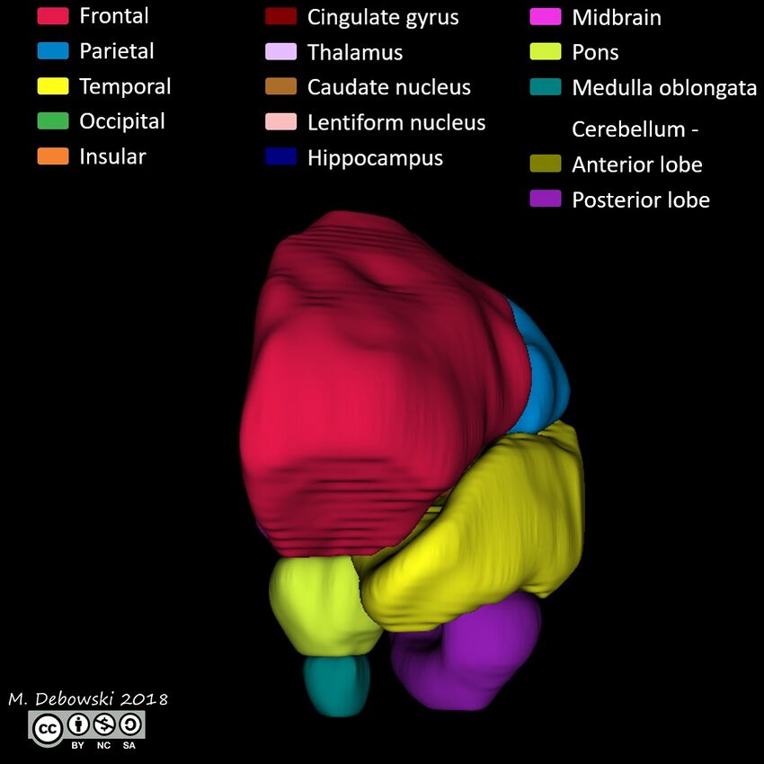 Brain lobes - annotated MRI (Radiopaedia 61691-69700 3D reconstruction 22).JPG