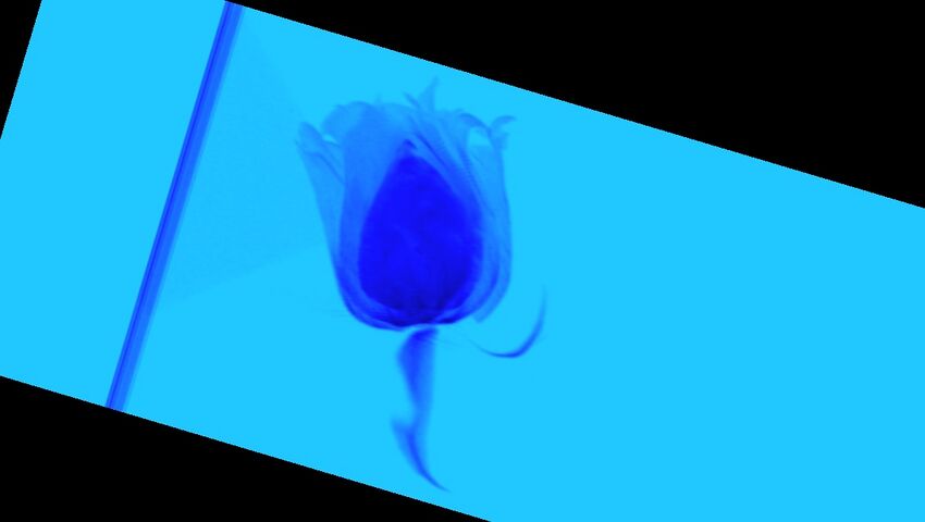 Blue rose (Radiopaedia 23430-23511 A 62).jpg