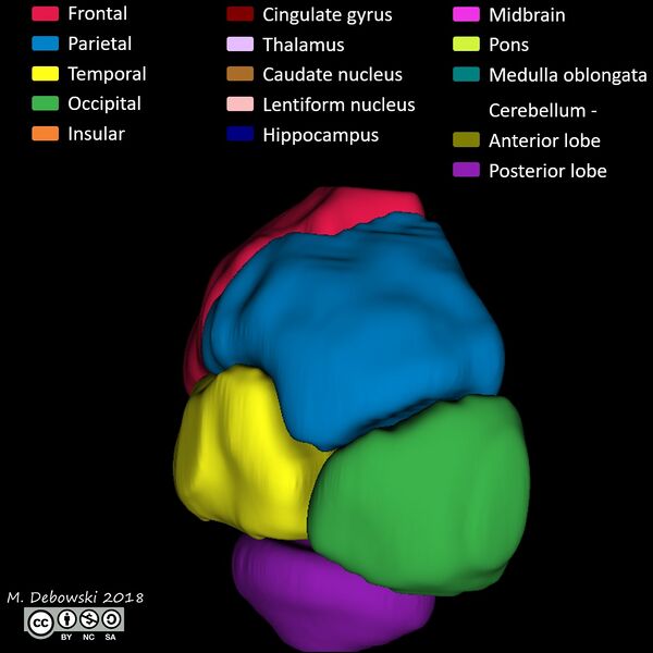 File:Brain lobes - annotated MRI (Radiopaedia 61691-69700 3D reconstruction 57).JPG