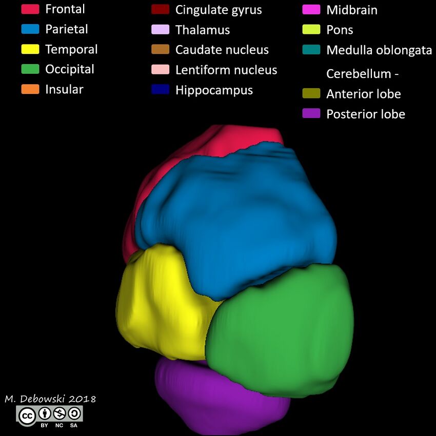 Brain lobes - annotated MRI (Radiopaedia 61691-69700 3D reconstruction 57).JPG