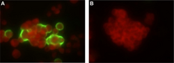 Adenovirus in the HEp-2 cells derived from swab samples (by indirect immunofluorescence assay).