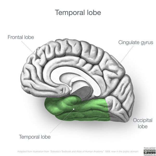 File:Neuroanatomy- medial cortex (diagrams) (Radiopaedia 47208-51763 Temporal lobe 2).png