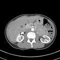 Normal multiphase CT liver (Radiopaedia 38026-39996 B 34).jpg