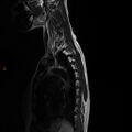 Normal spine MRI (Radiopaedia 77323-89408 E 14).jpg