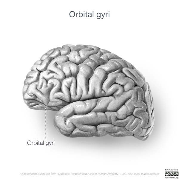 File:Neuroanatomy- lateral cortex (diagrams) (Radiopaedia 46670-51313 Orbital gyri 2).png