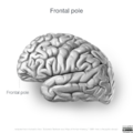 Neuroanatomy- lateral cortex (diagrams) (Radiopaedia 46670-51313 Frontal pole 2).png