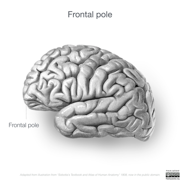 File:Neuroanatomy- lateral cortex (diagrams) (Radiopaedia 46670-51313 Frontal pole 2).png