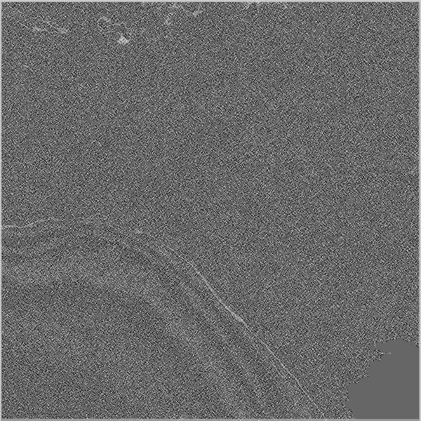 File:Normal cerebral angiogram (four vessel DSA) (Radiopaedia 41708-44649 C 2).png