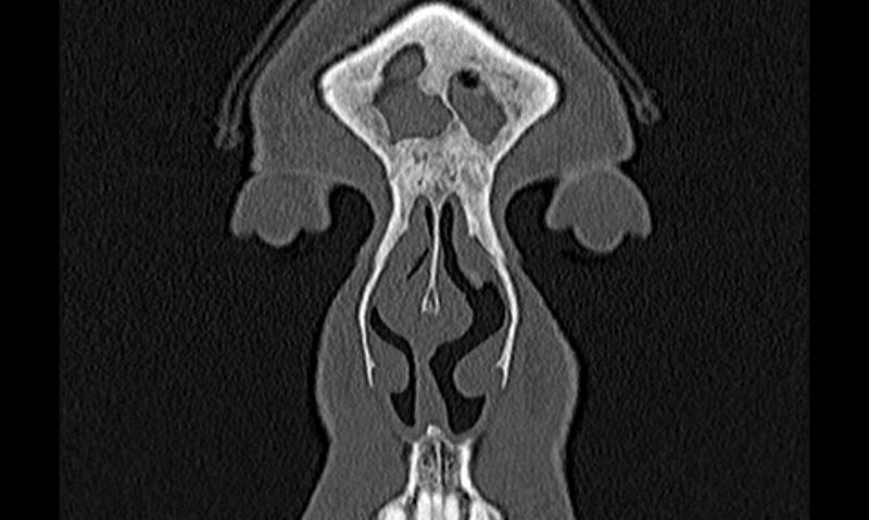 File:Chronic rhinosinusitis (Radiopaedia 65079-74075 Coronal bone window 3).jpg
