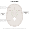 Base of skull (illustrations) (Radiopaedia 59251-66592 A 1).png