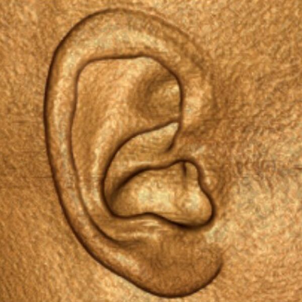 File:External ear (Radiopaedia 36309).jpg