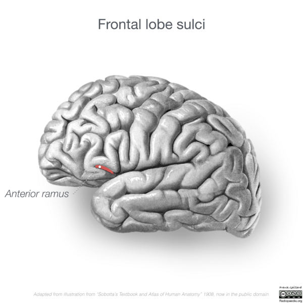 File:Neuroanatomy- lateral cortex (diagrams) (Radiopaedia 46670-51202 C 3).png