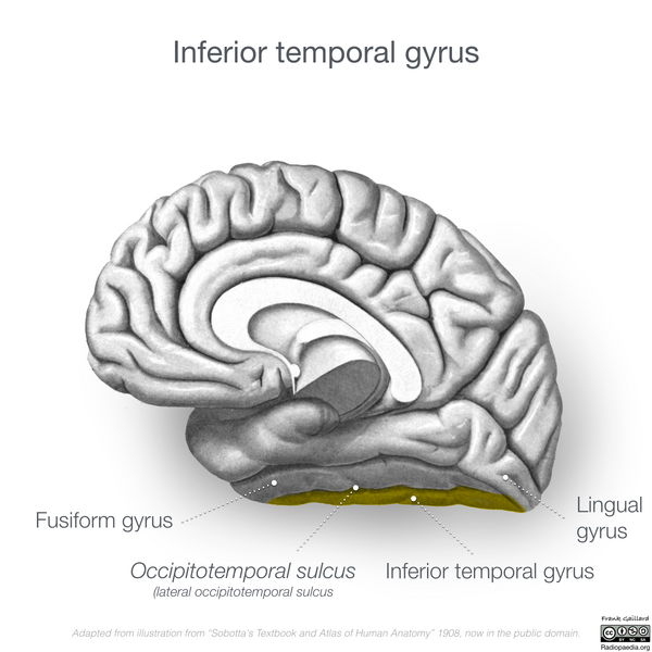 File:Neuroanatomy- medial cortex (diagrams) (Radiopaedia 47208-52697 N 1).png