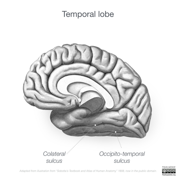 File:Neuroanatomy- medial cortex (diagrams) (Radiopaedia 47208-52697 Temporal lobe gyri 6).png