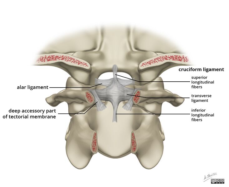 File:Alar and cruciform ligament anatomy (Radiopaedia 45136-49117 A 1).jpg