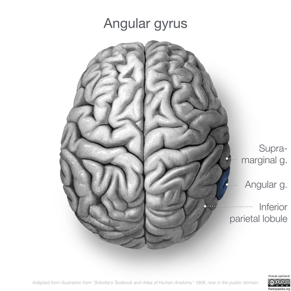 File:Neuroanatomy- superior cortex (diagrams) (Radiopaedia 59317-66671 Angular gyrus 1).png