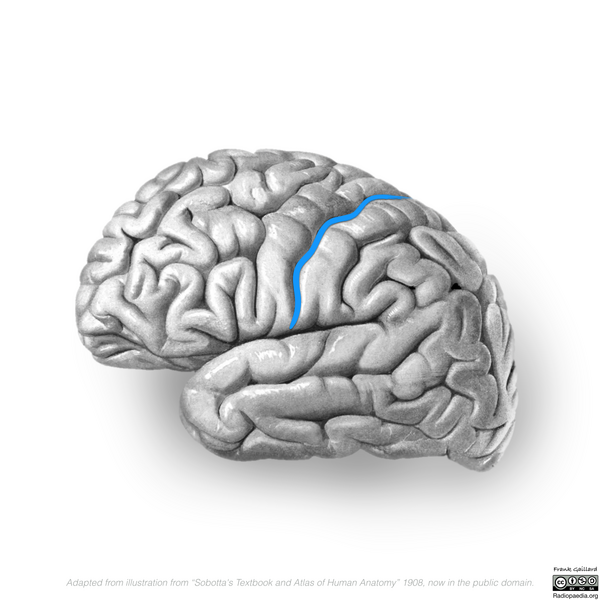File:Neuroanatomy- lateral cortex (diagrams) (Radiopaedia 46670-51202 Central sulcus 4).png