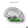 Neuroanatomy- medial cortex (diagrams) (Radiopaedia 47208-51763 Temporal lobe 4).png