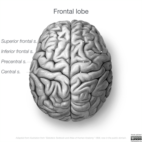 File:Neuroanatomy- superior cortex (diagrams) (Radiopaedia 59317-66670 Frontal lobe gyri 8).png