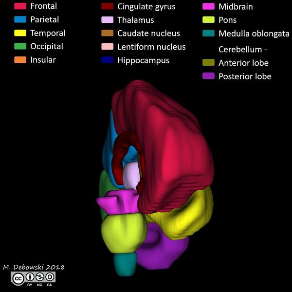 File:Brain lobes - annotated MRI (Radiopaedia 61691-69700 3D reconstruction 15).JPG